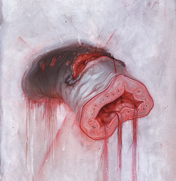 American_Heritage_-_Prolapse