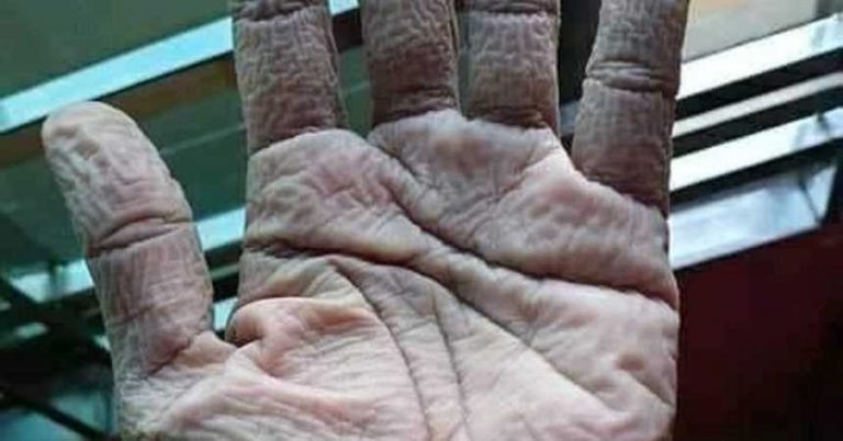 mano medico guantes