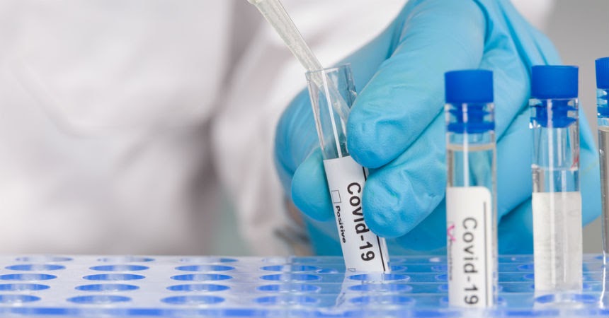 suero caballos coronavirus