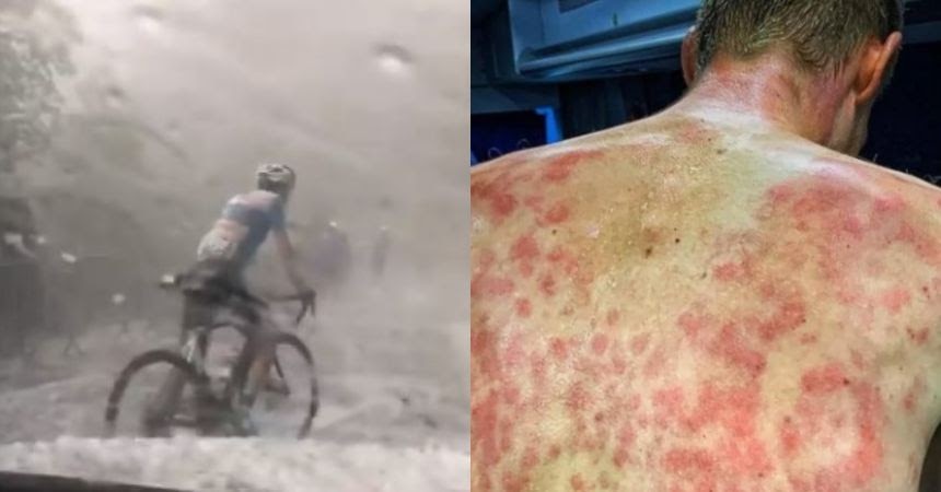 ciclistas granizos