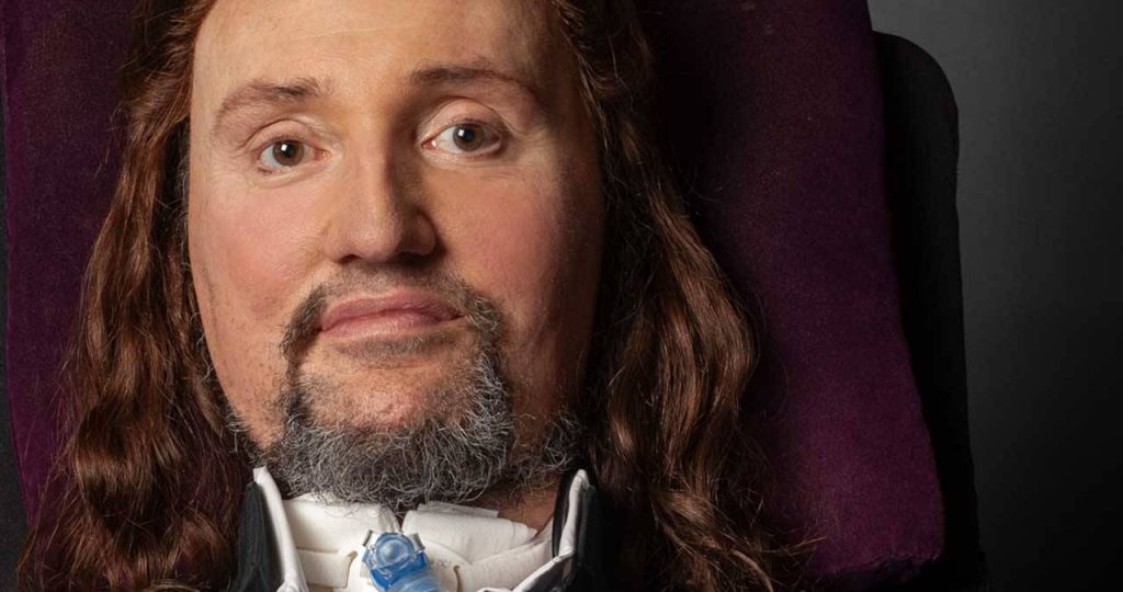 Jason Becker Salud Web