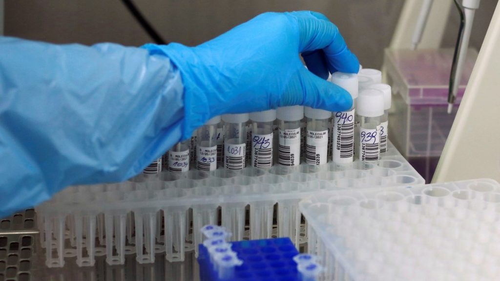 Coronavirus Minsal Covid-19 casos