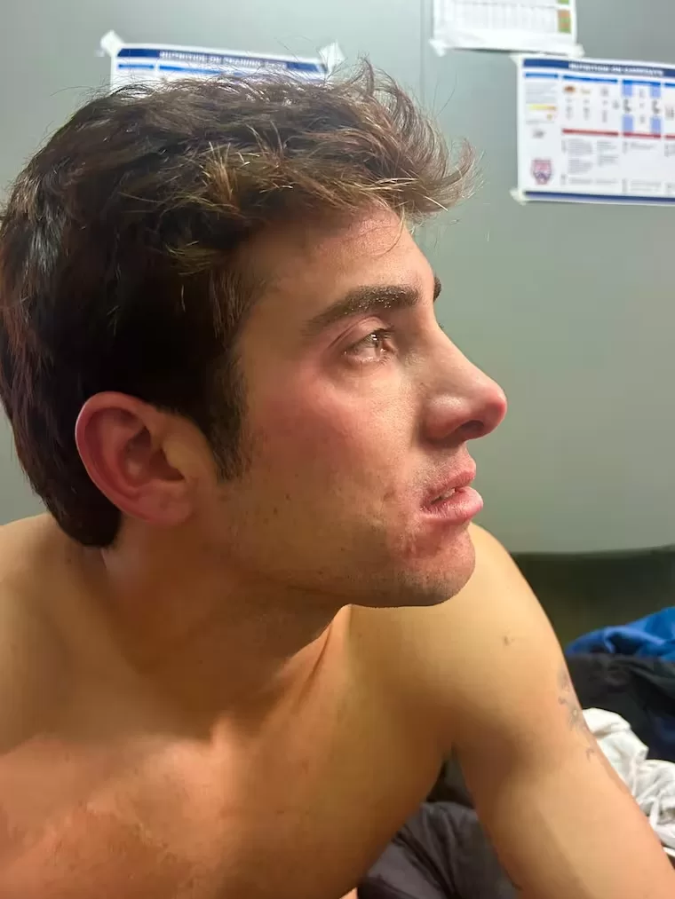 Cristian Garin Agresion